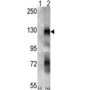 EPH Receptor A6 (EphA6) Antibody