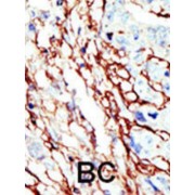 EPH Receptor A7 (EphA7) Antibody