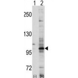 EPH Receptor A7 (EphA7) Antibody
