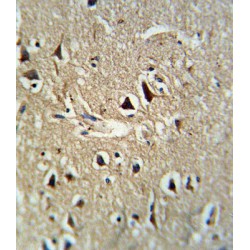 Proprotein Convertase Subtilisin/Kexin Type 2 (PCSK2) Antibody