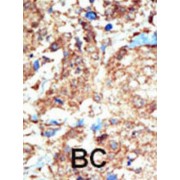 Ephrin Type-B Receptor 1 (EphB1) Antibody