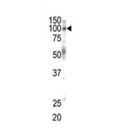 Ephrin Type-B Receptor 1 (EphB1) Antibody