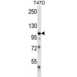 Ephrin Type-B Receptor 1 (EphB1) Antibody