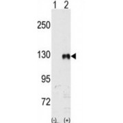 Ephrin Type-B Receptor 1 (EphB1) Antibody
