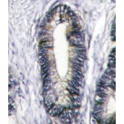 Ephrin Type-B Receptor 2 (EphB2) Antibody