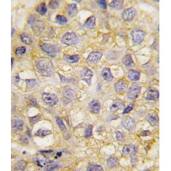 Ephrin Type-B Receptor 2 (EphB2) Antibody