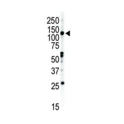 Ephrin Type-B Receptor 2 (EphB2) Antibody