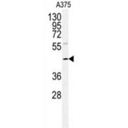 DNA Polymerase Delta Interacting Protein 2 (POLDIP2) Antibody