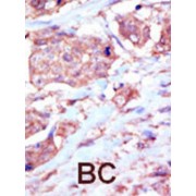 Ephrin Type-B Receptor 6 (EphB6) Antibody