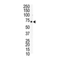 Ephrin Type-B Receptor 6 (EphB6) Antibody