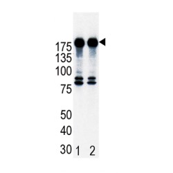 Receptor Tyrosine-Protein Kinase ErbB-2 (ERBB2) Antibody