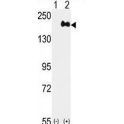 Receptor Tyrosine-Protein Kinase ErbB-2 (ERBB2) Antibody