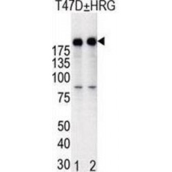 Receptor Tyrosine-Protein Kinase ErbB-2 (ERBB2) Antibody
