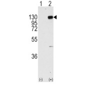 Fibroblast Growth Factor Receptor 1 (FGFR1) Antibody