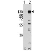 abx033555