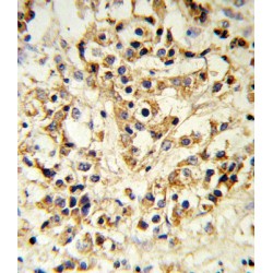 Fibroblast Growth Factor Receptor 1 (FGFR1) Antibody