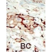 Fibroblast Growth Factor Receptor 2 (FGFR2) Antibody