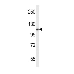 Fibroblast Growth Factor Receptor 2 (FGFR2) Antibody