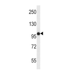 Fibroblast Growth Factor Receptor 2 (FGFR2) Antibody