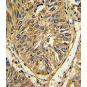 abx033561