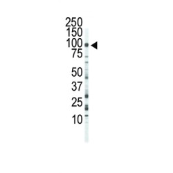 Fibroblast Growth Factor Receptor 3 (FGFR3) Antibody