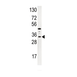 Insulin-Like Growth Factor-Binding Protein 3 (IGFBP3) Antibody