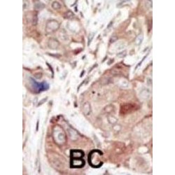 Vascular Endothelial Growth Factor Receptor 2 / VEGFR2 (KDR) Antibody