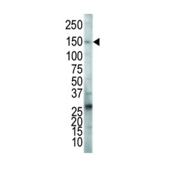 Vascular Endothelial Growth Factor Receptor 2 / VEGFR2 (KDR) Antibody