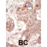 abx033569