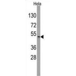 Integrin-Linked Protein Kinase (ILK) Antibody