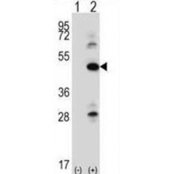 Integrin-Linked Protein Kinase (ILK) Antibody