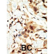 abx033580