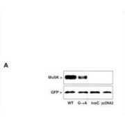 Muscle Skeletal Receptor Tyrosine Kinase (MUSK) Antibody