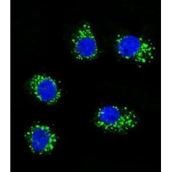 Muscle Skeletal Receptor Tyrosine Kinase (MUSK) Antibody