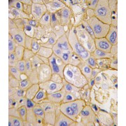 abx033593