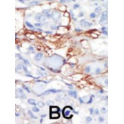 abx033595