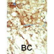 Retinol (RET) Antibody