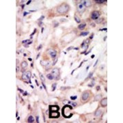 abx033603