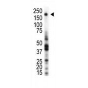 Macrophage-Stimulating Protein Receptor (RON) Antibody