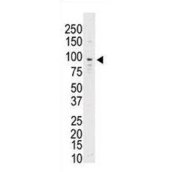 Tyrosine-Protein Kinase Receptor TYRO3 (TYRO3) Antibody