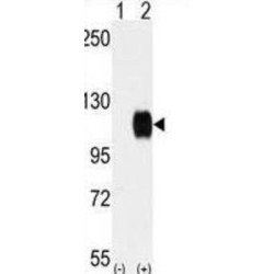 Tyrosine-Protein Kinase Receptor TYRO3 (TYRO3) Antibody