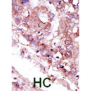 Serine/Threonine Kinase 33 (STK33) Antibody