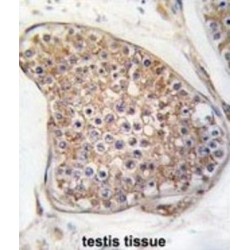 Angiopoietin-1 Receptor / TIE2 (TEK) Antibody