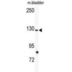 Tyrosine-Protein Kinase Receptor Tie-1 (TIE1) Antibody