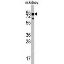 High Affinity Nerve Growth Factor Receptor (NTRK1) Antibody