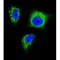 High Affinity Nerve Growth Factor Receptor (NTRK1) Antibody