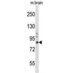 High Affinity Nerve Growth Factor Receptor (NTRK1) Antibody