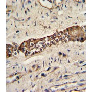 IHC analysis of formalin-fixed and paraffin-embedded human normal lung with TYRO10 Antibody, which was peroxidase-conjugated to the secondary antibody, followed by DAB staining.