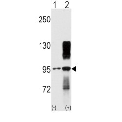 Tyrosine-Protein Kinase TYRO10 (TYRO10) Antibody