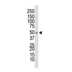 Docking Protein 1 (DOK1) Antibody